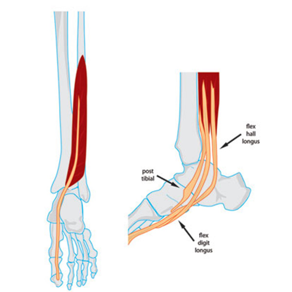 FHL-Tendinopathy-ICON (1)