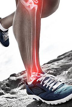 Shin Splints